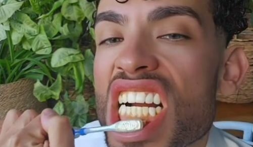 Vignette d'une vidéo Tiktok vantant les mérites du curcuma pour blanchir les dents